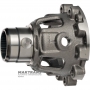 Корпус диференціалу A8LF1 4WD - 458224G150, 458214G100 (10 кріпильних отворів косозубої шестерні)